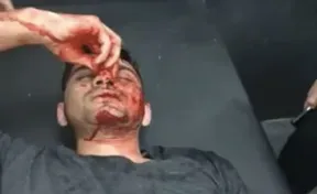 Jammu: Kashmiri Muslim students in medical college assaulted over criticism of a Hindutva film